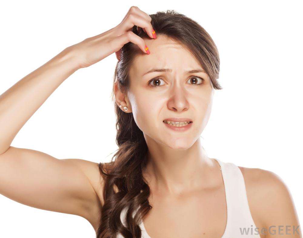woman-in-white-shirt-scratching-head